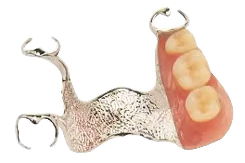 vip dental lab partial denture